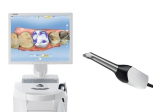 McLean dentist CEREC Single Visit Crowns