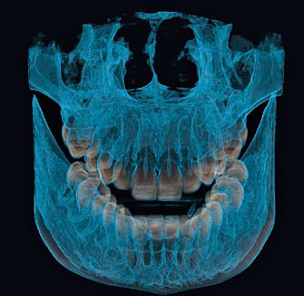 3D X-Rays