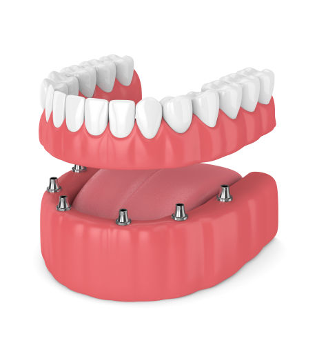 dentures mclean va