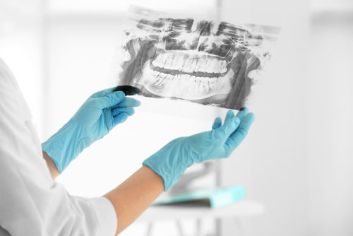 dental exam mclean va